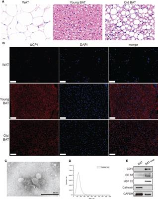 Brown adipose tissue-derived exosomes delay fertility decline in aging mice